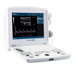 Alternative view of EDAN DUS 60 Portable Ultrasound Scan Machine